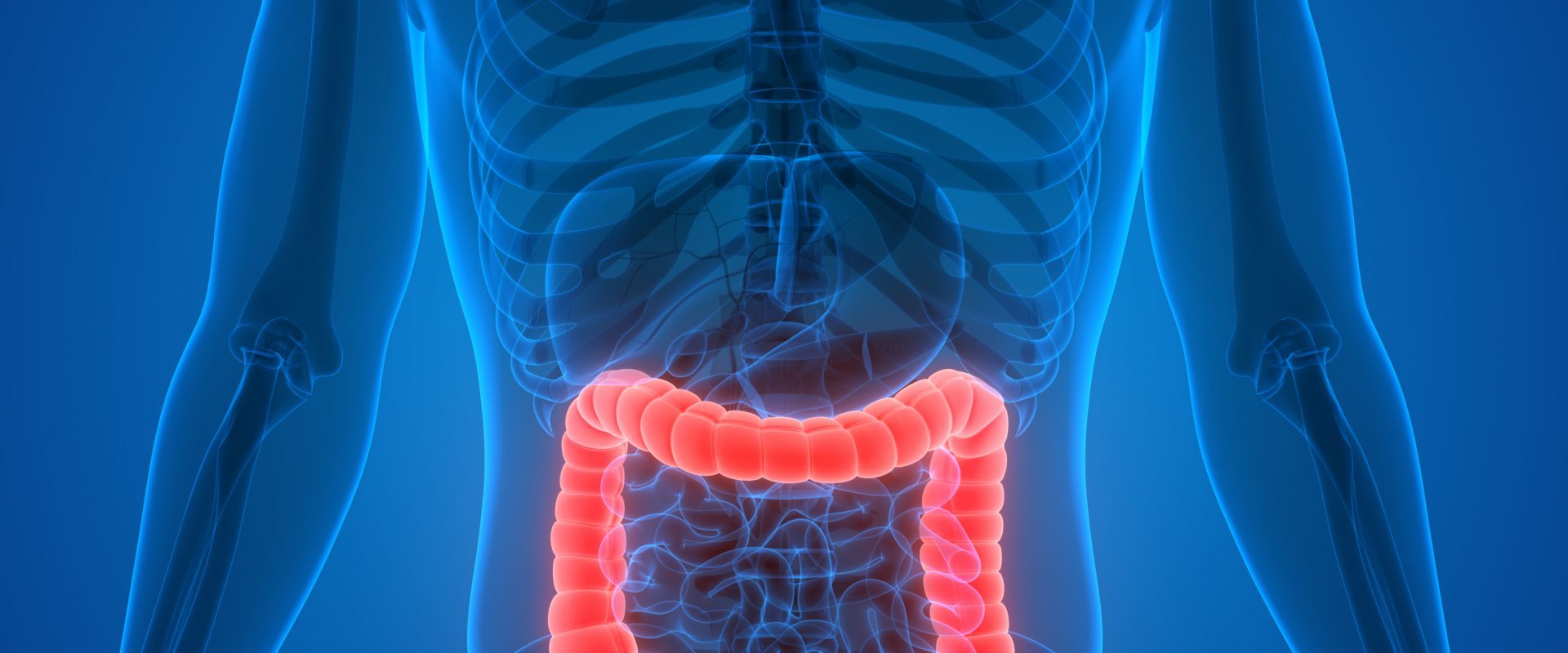 Colorectal Cancer graphic